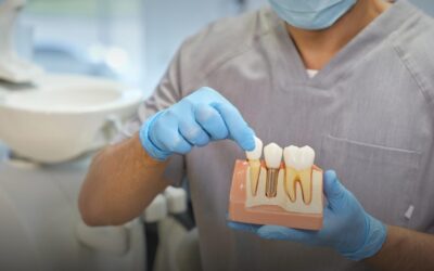Dental Implants: Why They’re Worth The Investment