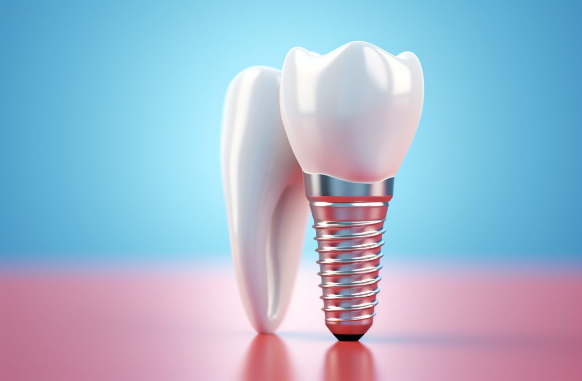 dental-implants-for-launceston-patients-1200x786