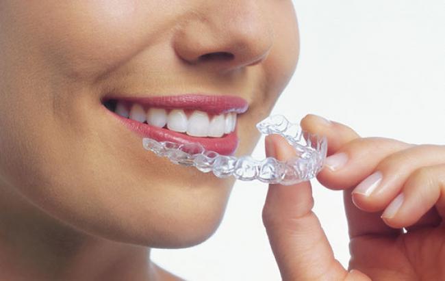 invisalign-for-launceston-tasmania
